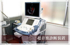 超音波診断装置